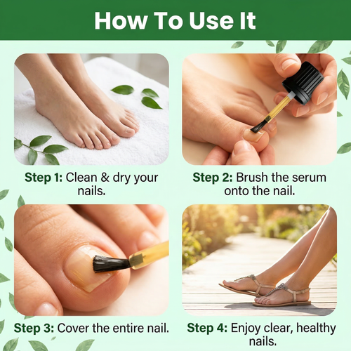 Keraclear Antifungal Nail Serum